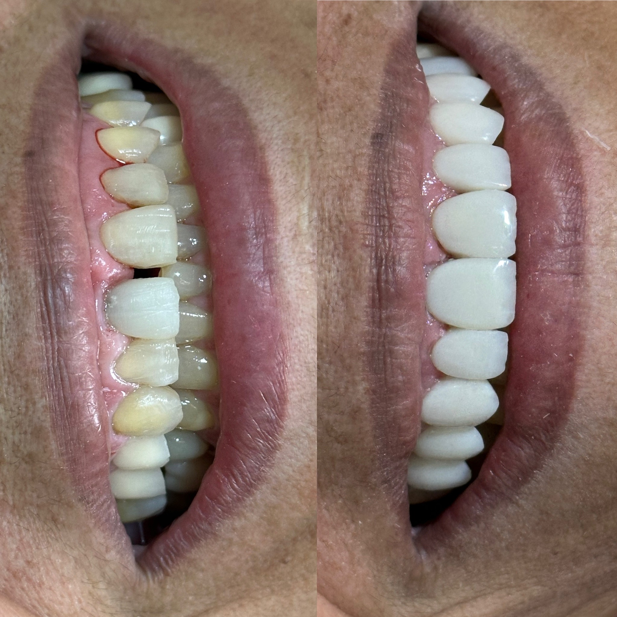 4D612885-010D-427E-853F-D4338C4B3C52