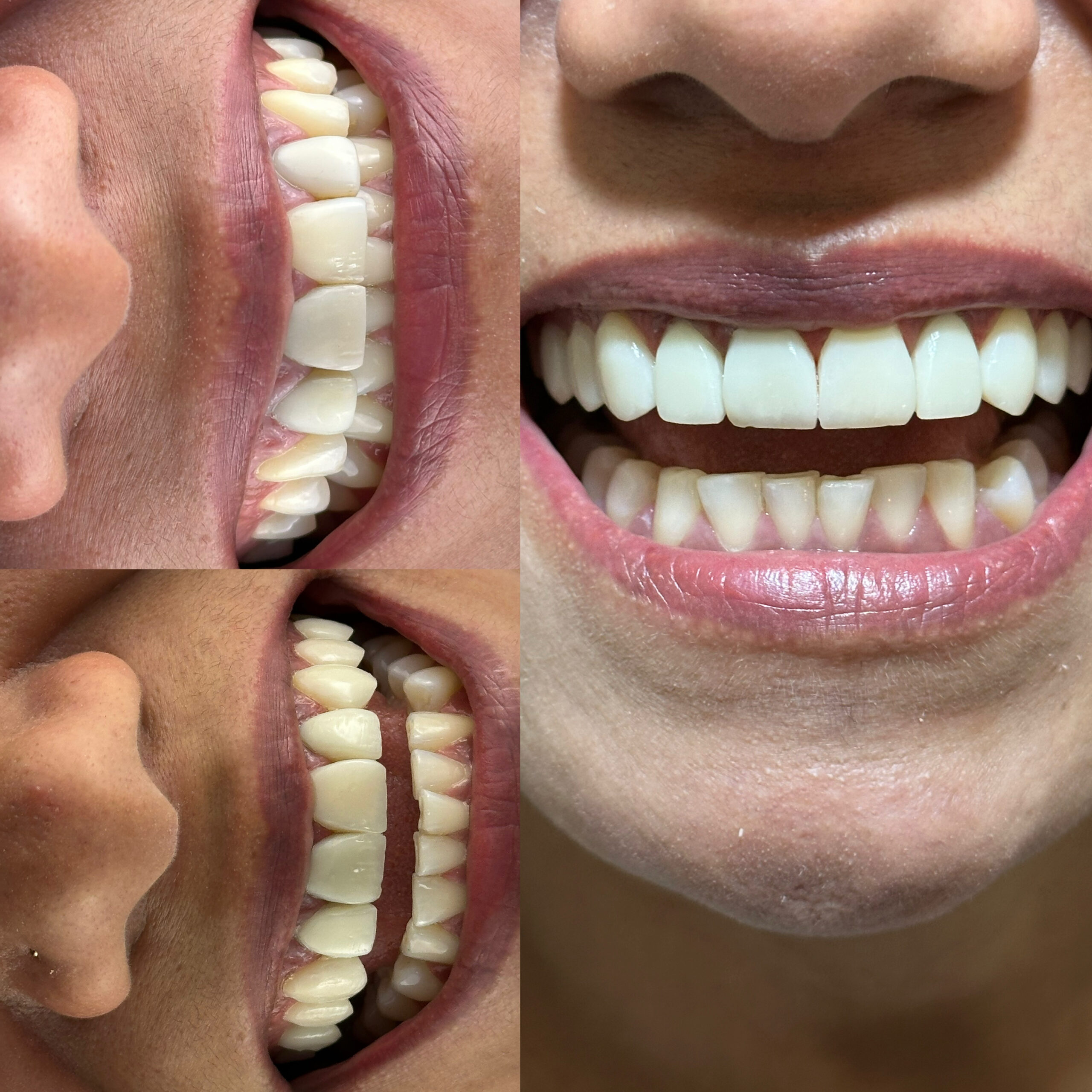 623F8256-B459-4670-A19E-71A3D97AD5EB