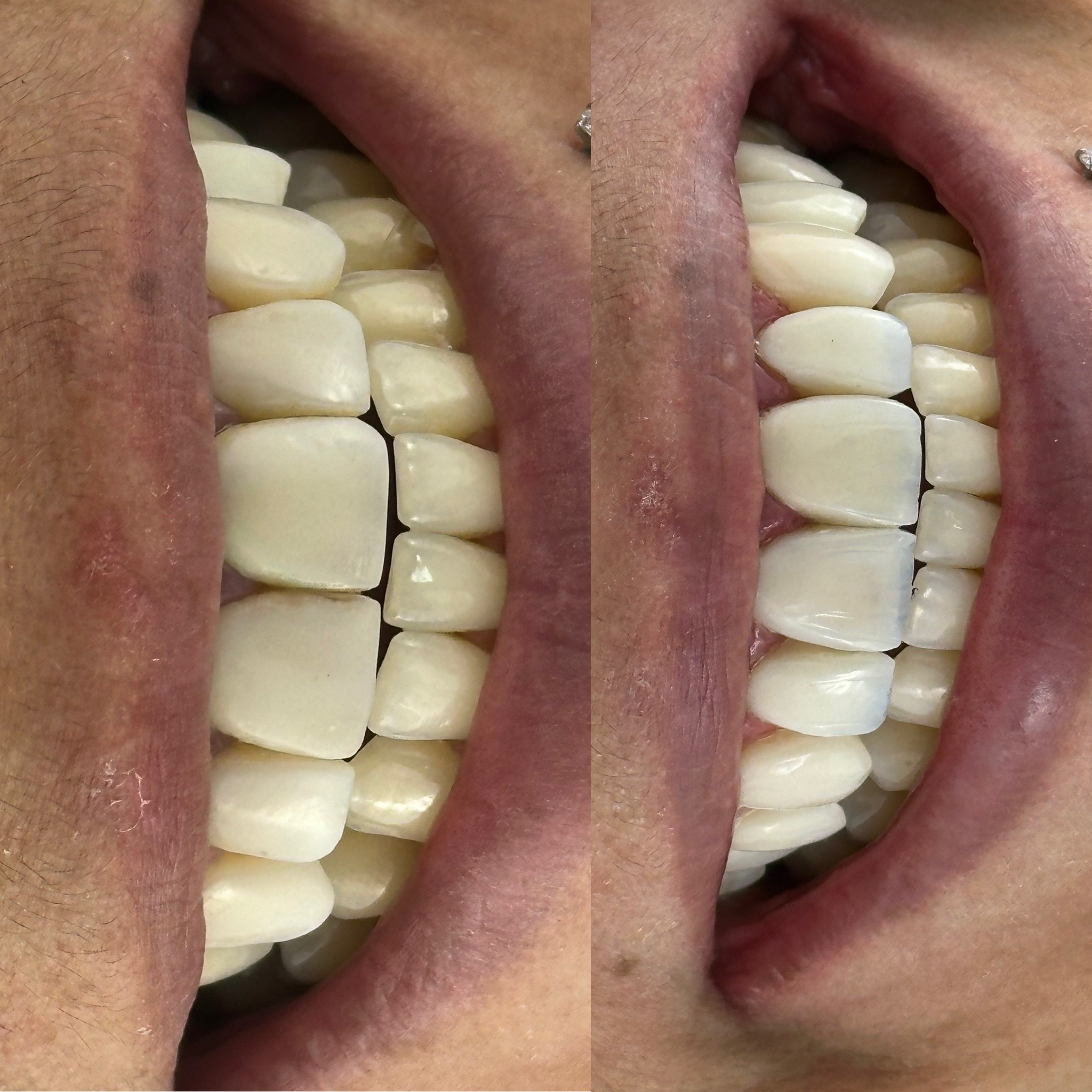 82D19A98-2BFD-4C51-8520-FB1E716923CB