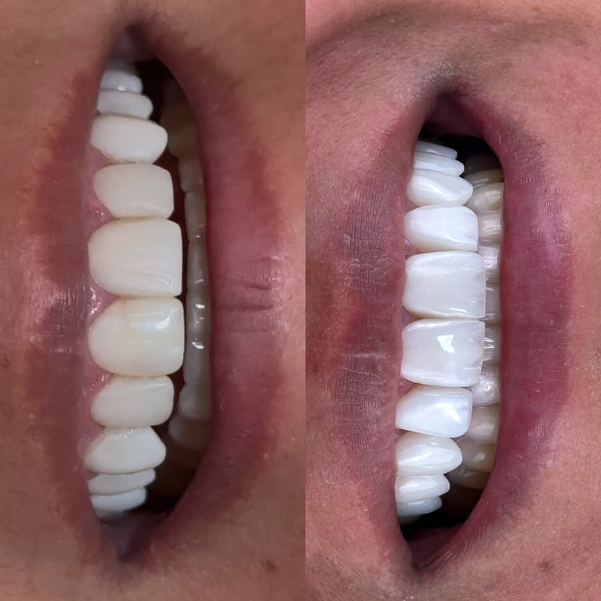 B361CE50-50C8-41E4-A8EF-7D0A1BDC0520